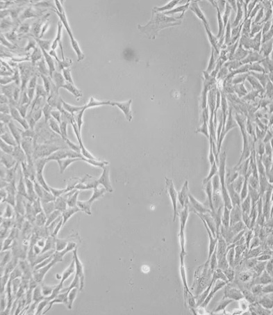明美倒置荧光显微镜MF53-N助力中国药科大学团队发现高血压血管重构重要靶点